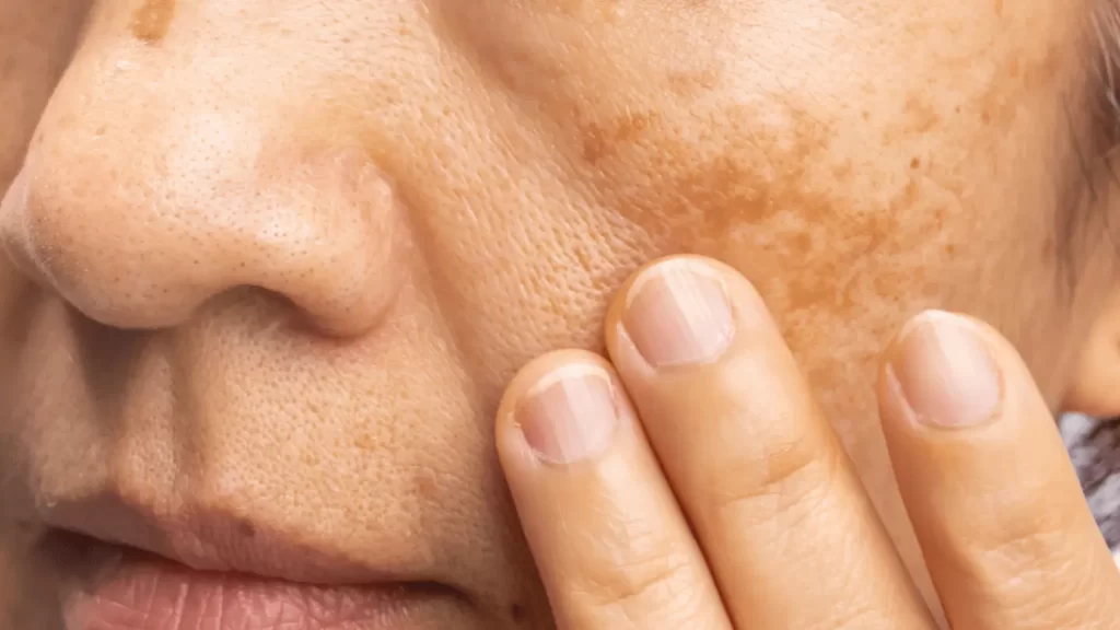 How DNA Testing Can Help You Prevent Skin Aging